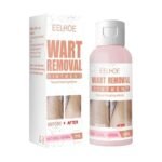 Eelhoe Wart Removal Ointment – Fast Herbal Treatment for Skin Warts & Moles - Image 2